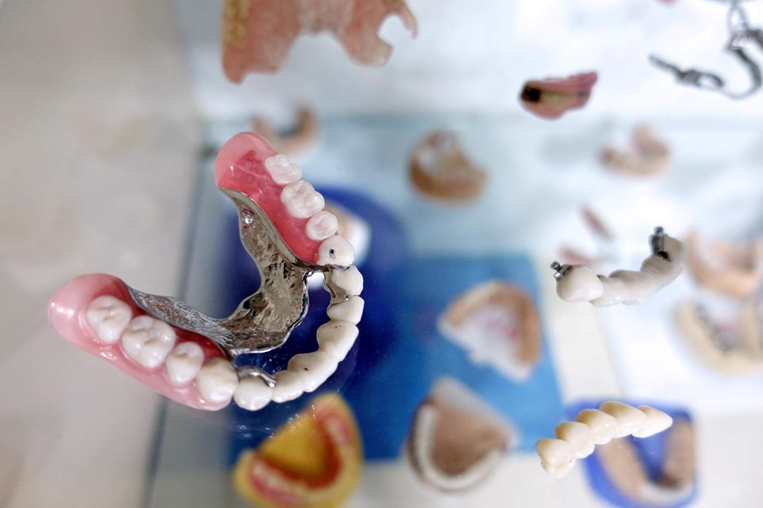 Dentista prótesis dentales en Leganés